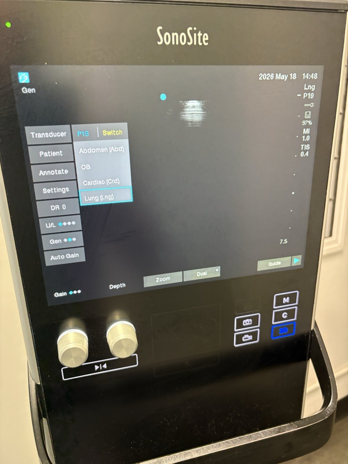 Sonosite SII Total Ultrasound System Ref P20883-12 With Three Probes (PLS READ)