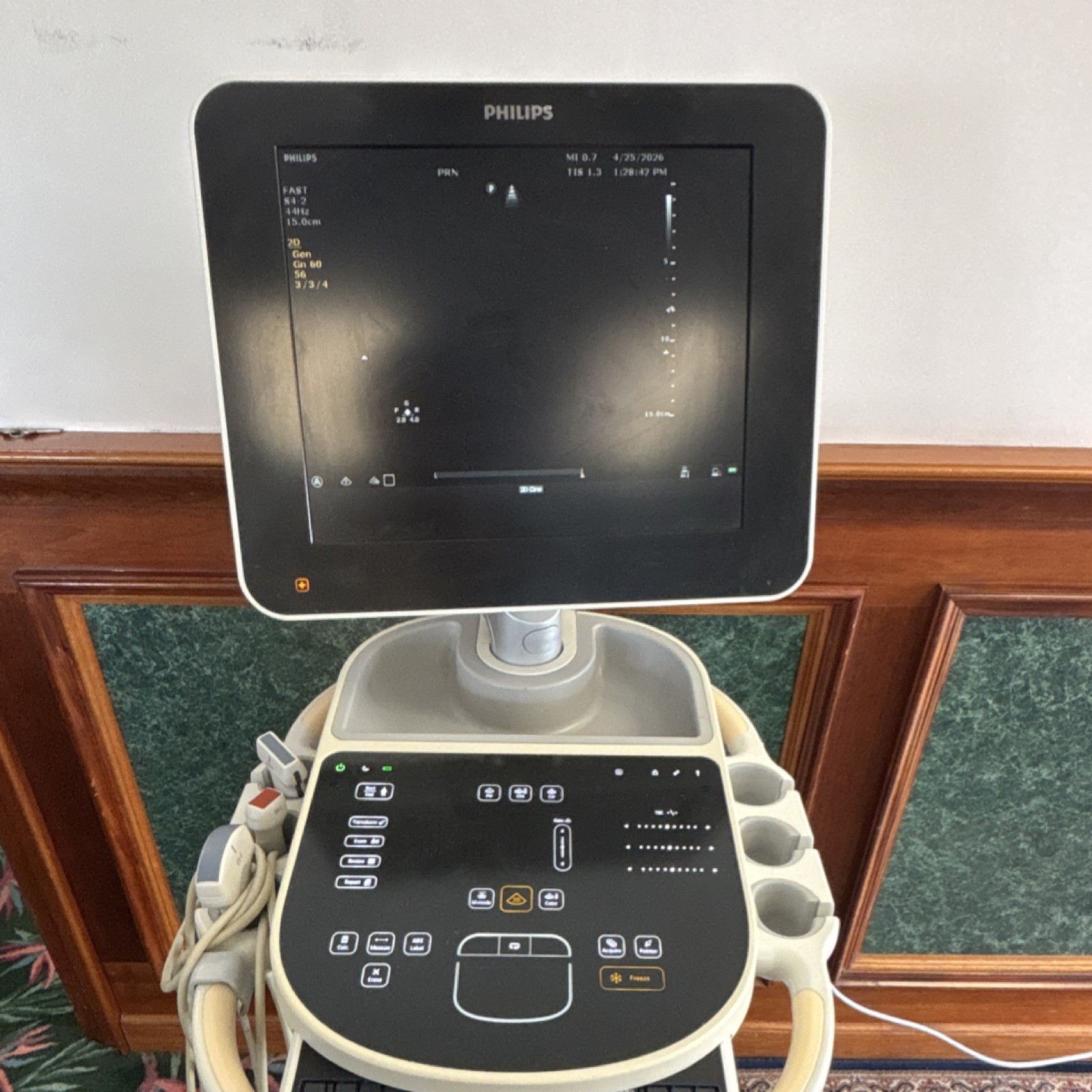 Philips Sparq Cart Mounted Ultrasound Machine Color Doppler with 3 probes