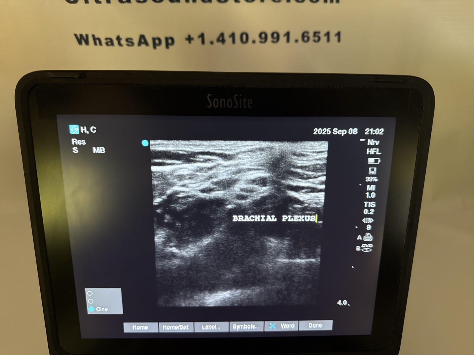 SONOSITE EDGE II 2018 Phased & Linear Transducers. 60 Day Money Back Guarantee