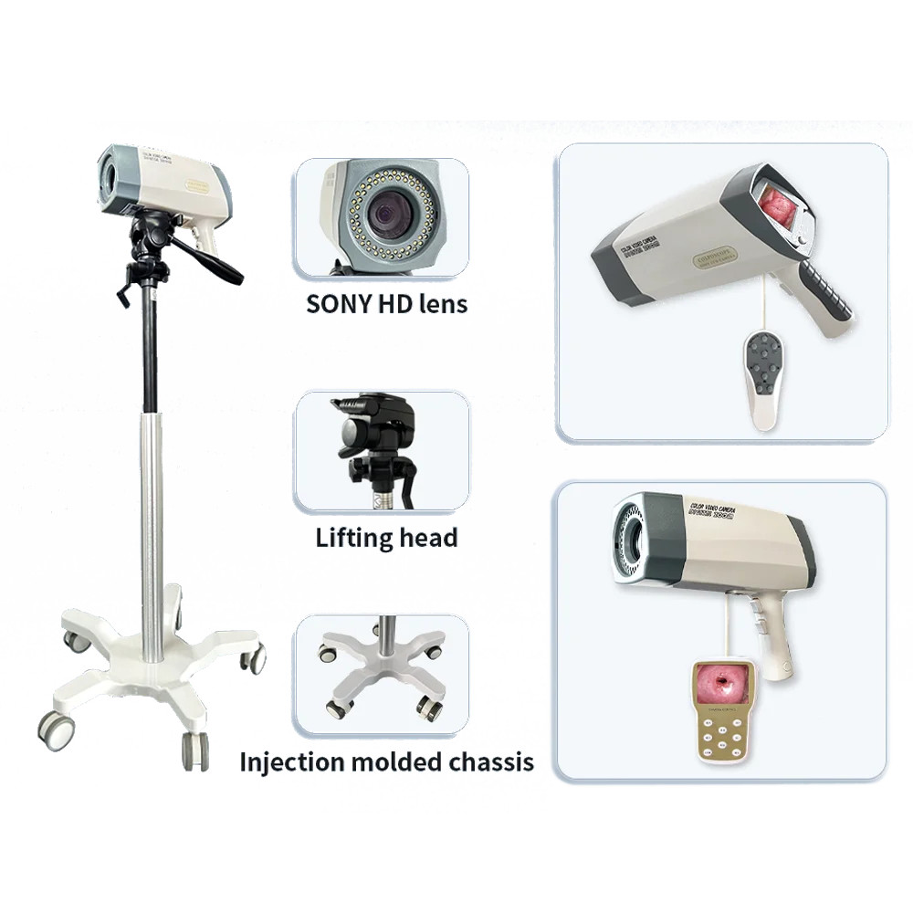 Electronic Digital Colposcope Video HD For Gynecology Colposcopy Imaging System
