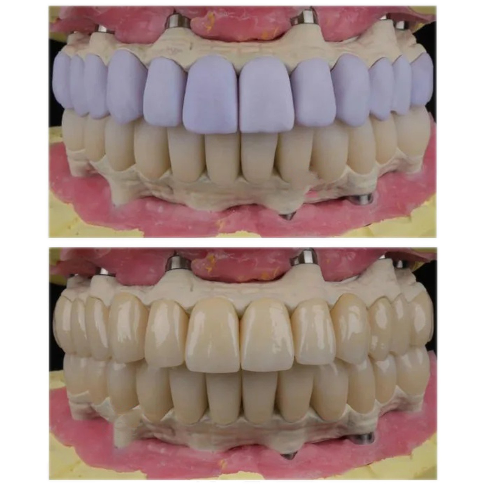 US Dental Emax Glass Ceramic Blocks C14 HT/LT Lithium Disilicate CAD/CAM CEREC