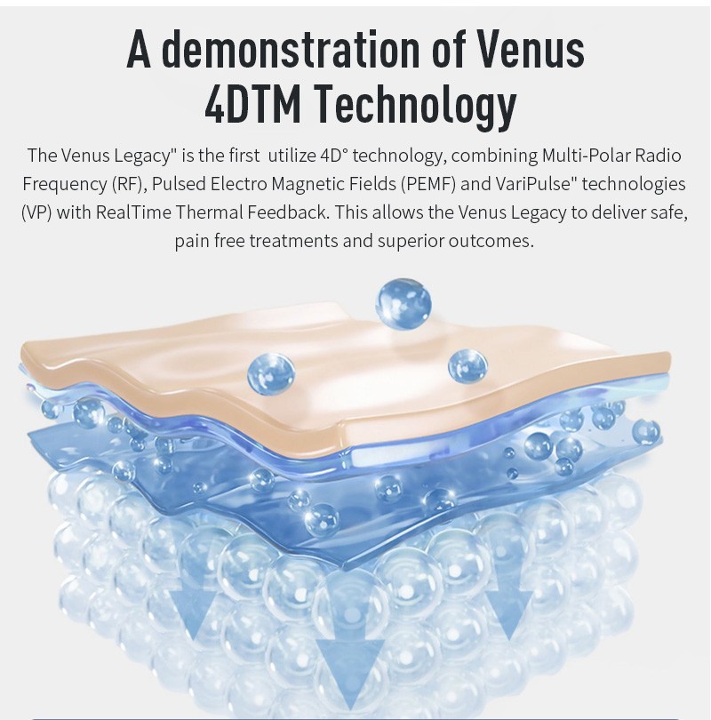 Venus Concept Venus Legacy Radiofrequency Cart-Mounted Skin Tightening