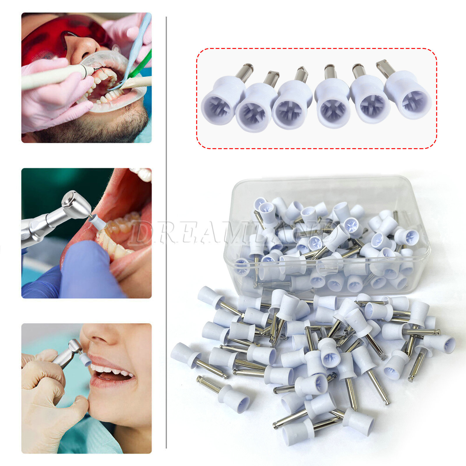 100 Pcs Dental Polishing Prophy Prophylaxis Cups Latch Type Rubber Polisher