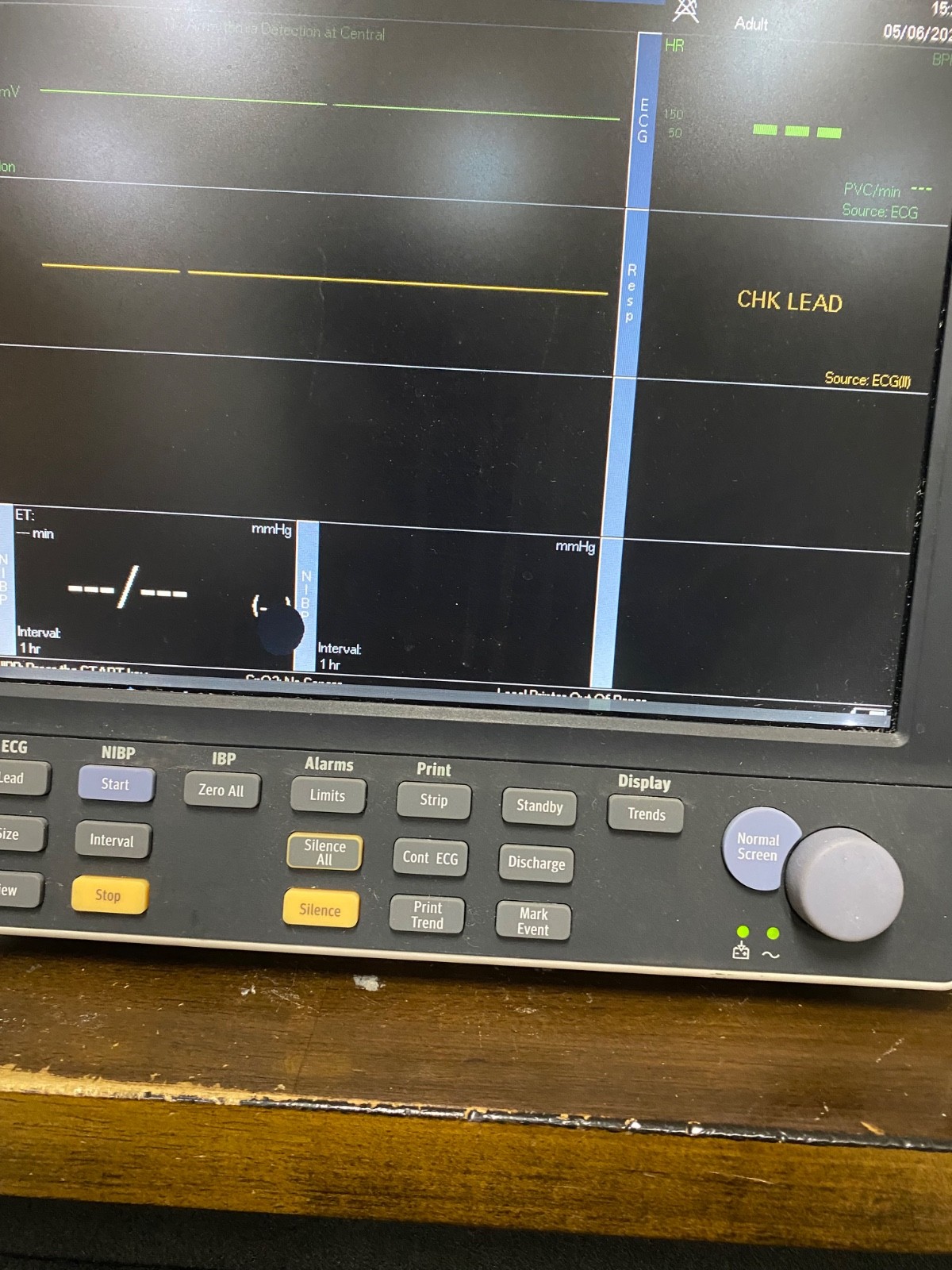 MINDRAY Datascope Passport V Patient Monitor Screen Damage Powers on