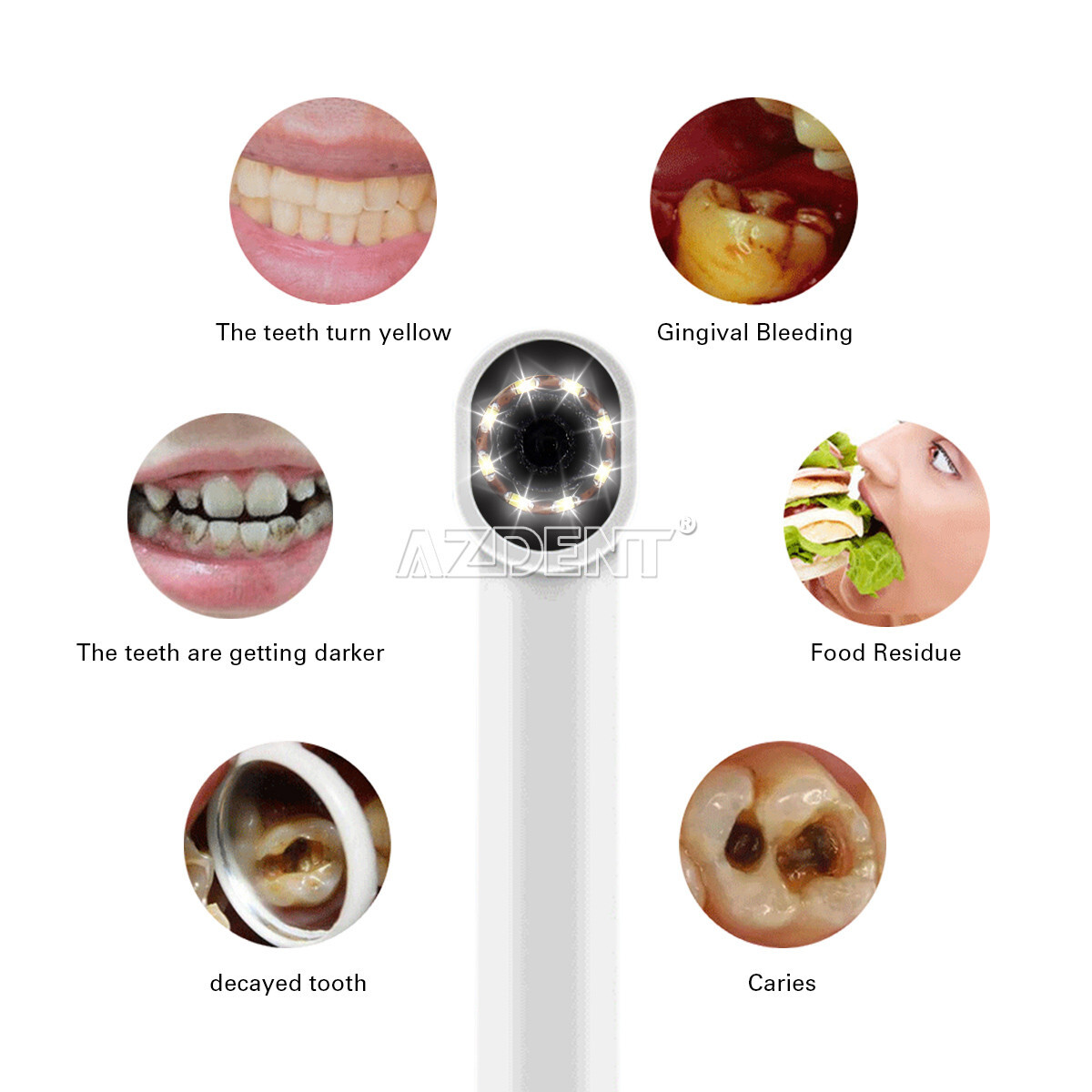 AZDENT Dental Intraoral Camera USB Imaging Intra Oral HD Camera 8 LED light