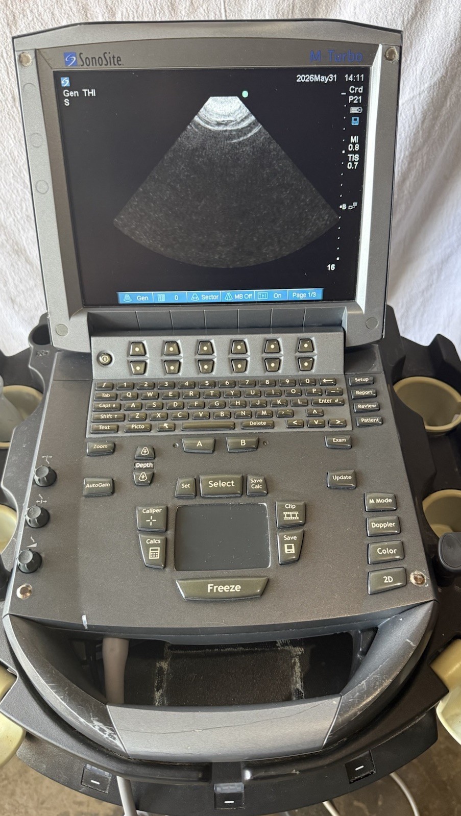SonoSite M-Turbo Ultrasound System (2014) With 2 Transducer Probe & Rolling Car