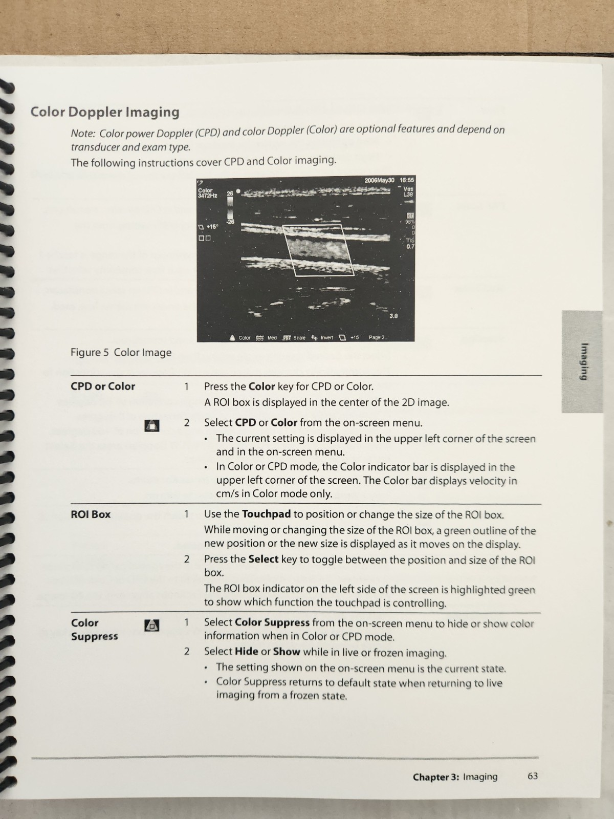 SonoSite MicroMaxx PORTABLE ULTRASOUND with C11e/P17/ECG probes, tested, due2025