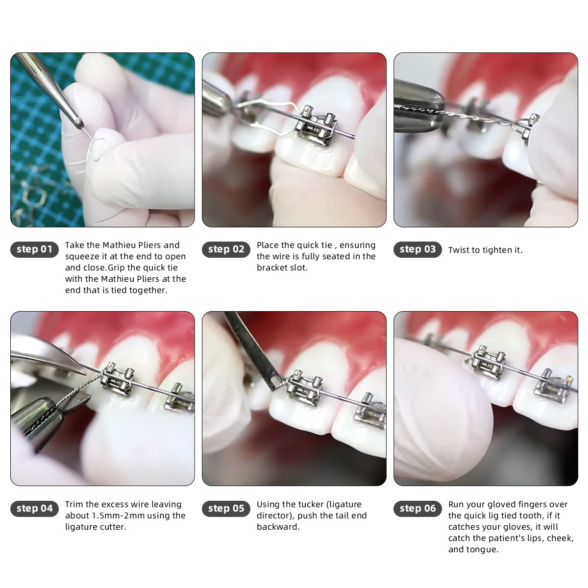Dental Orthodontic Wire Preformed/Kobayashi Ligature Wire Ties Long /Short Twist