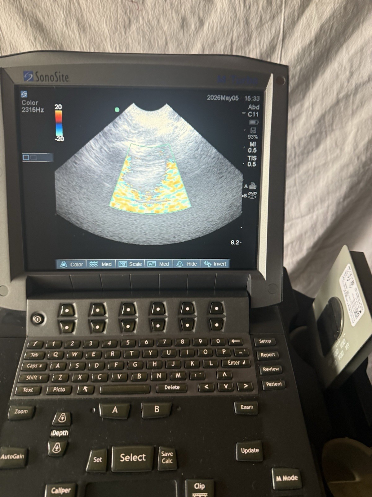 SonoSite M-turbo Portable Vet Ultrasound w/ C11x & P21x Transducer Probe