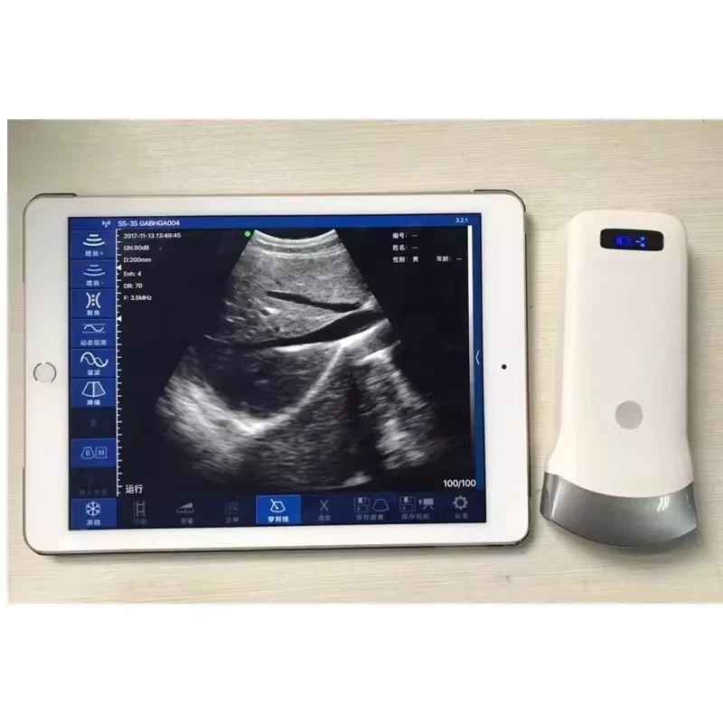 Wireless Ultrasound Probe Scanner Portable Machine Support iOS Android Windows