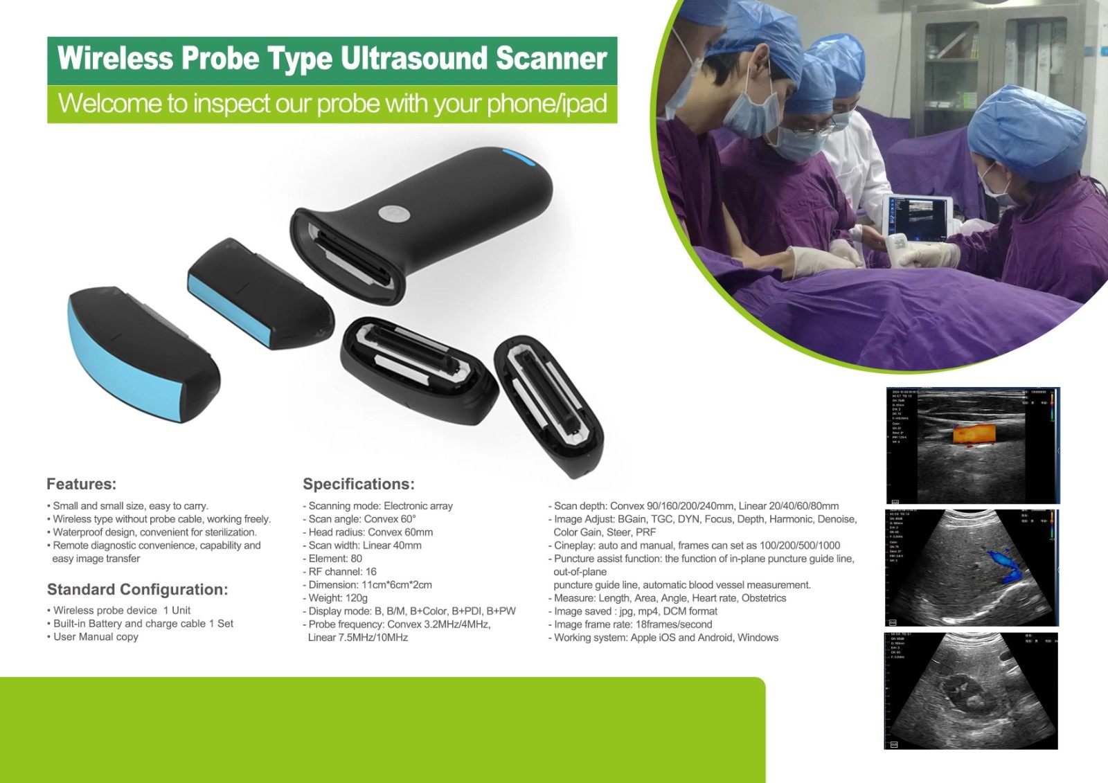 Wireless Ultrasound, Swappable Linear/Convex Probes, Palm Color Doppler Scanner