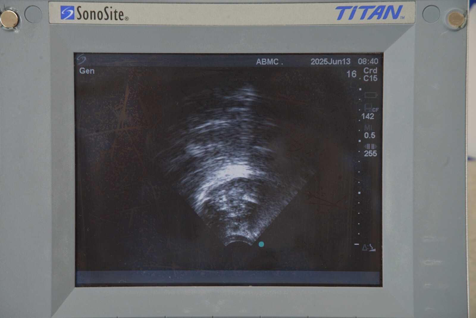 SonoSite Titan High-Resolution Imaging System W/ C15/4-2 MHz & Cart