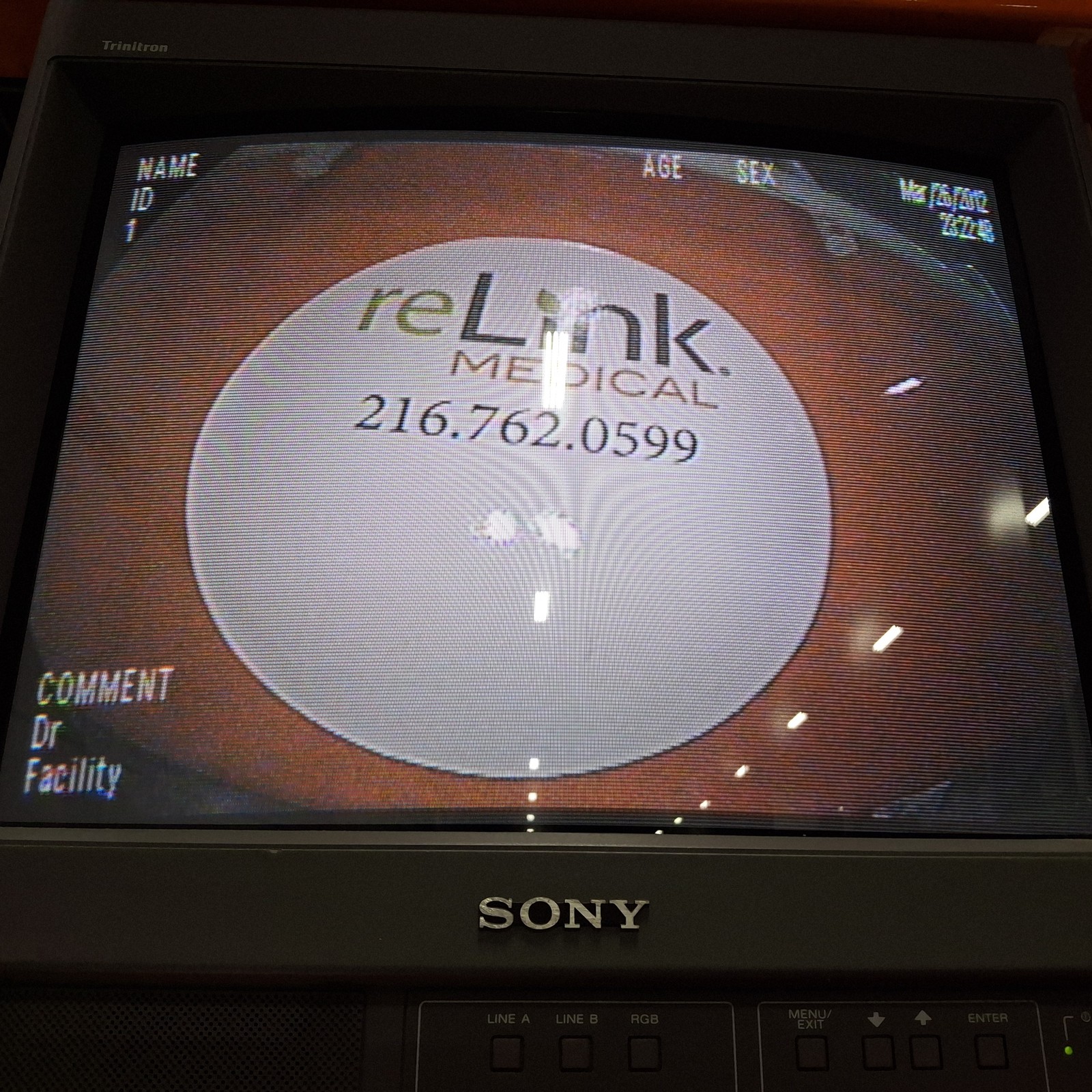 Pentax Medical EC-3490Li High Definition Pediatric Video Colonoscopepe