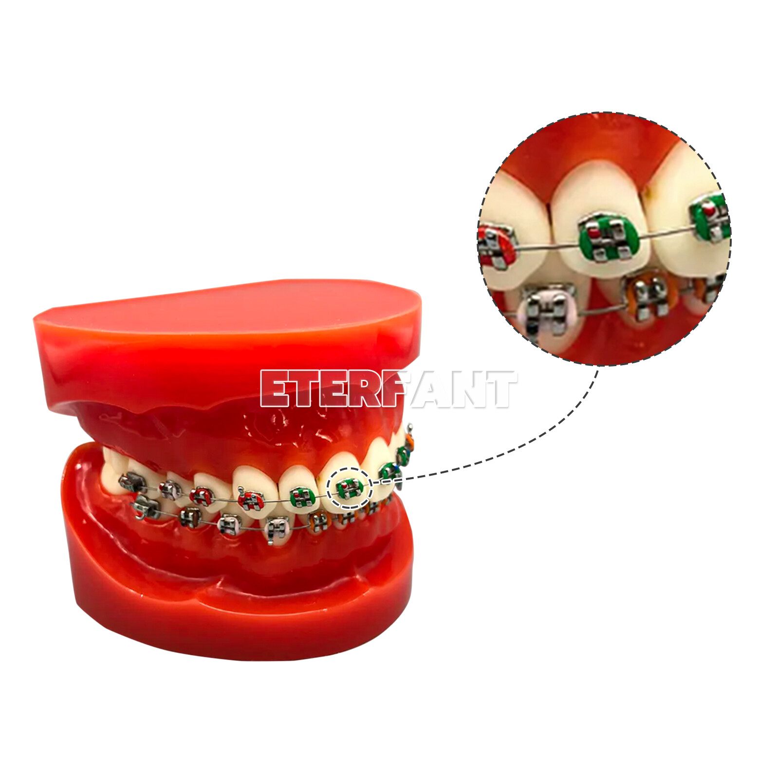 1040PCs ETERFANT Dental Orthodontic Ligature Ties Elastic Rubber Bands Brackets