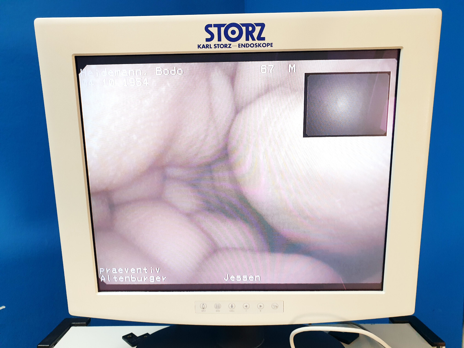 Pentax EPK-1000 + Basic 30 + EC-380FK2p Colonoscope – Video Colonoscope
