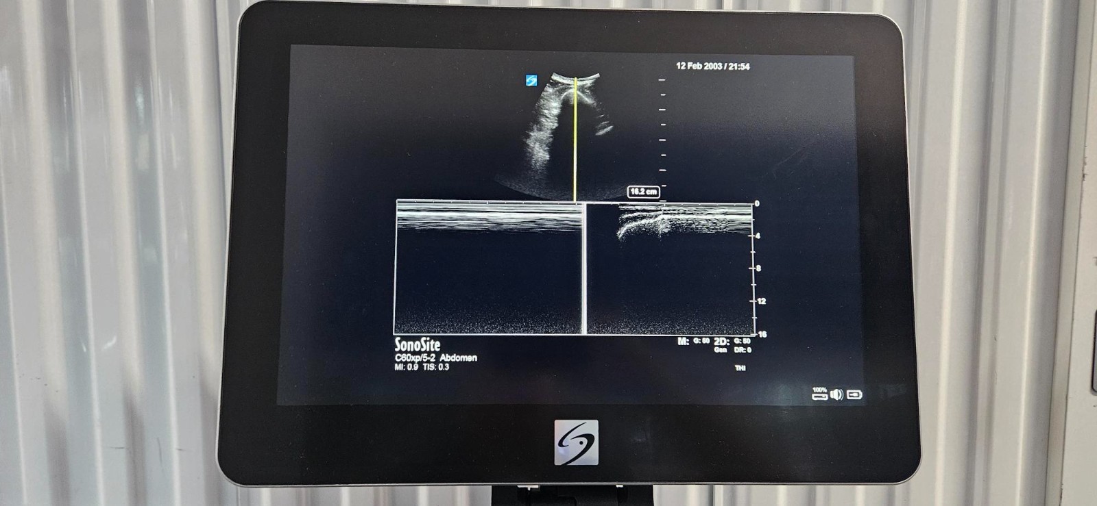 SonoSite X-Porte Ultrasound