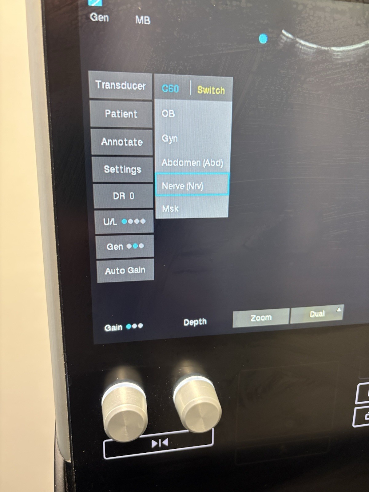 Sonosite SII Total Ultrasound System Ref P20883-12 With Three Probes (PLS READ)