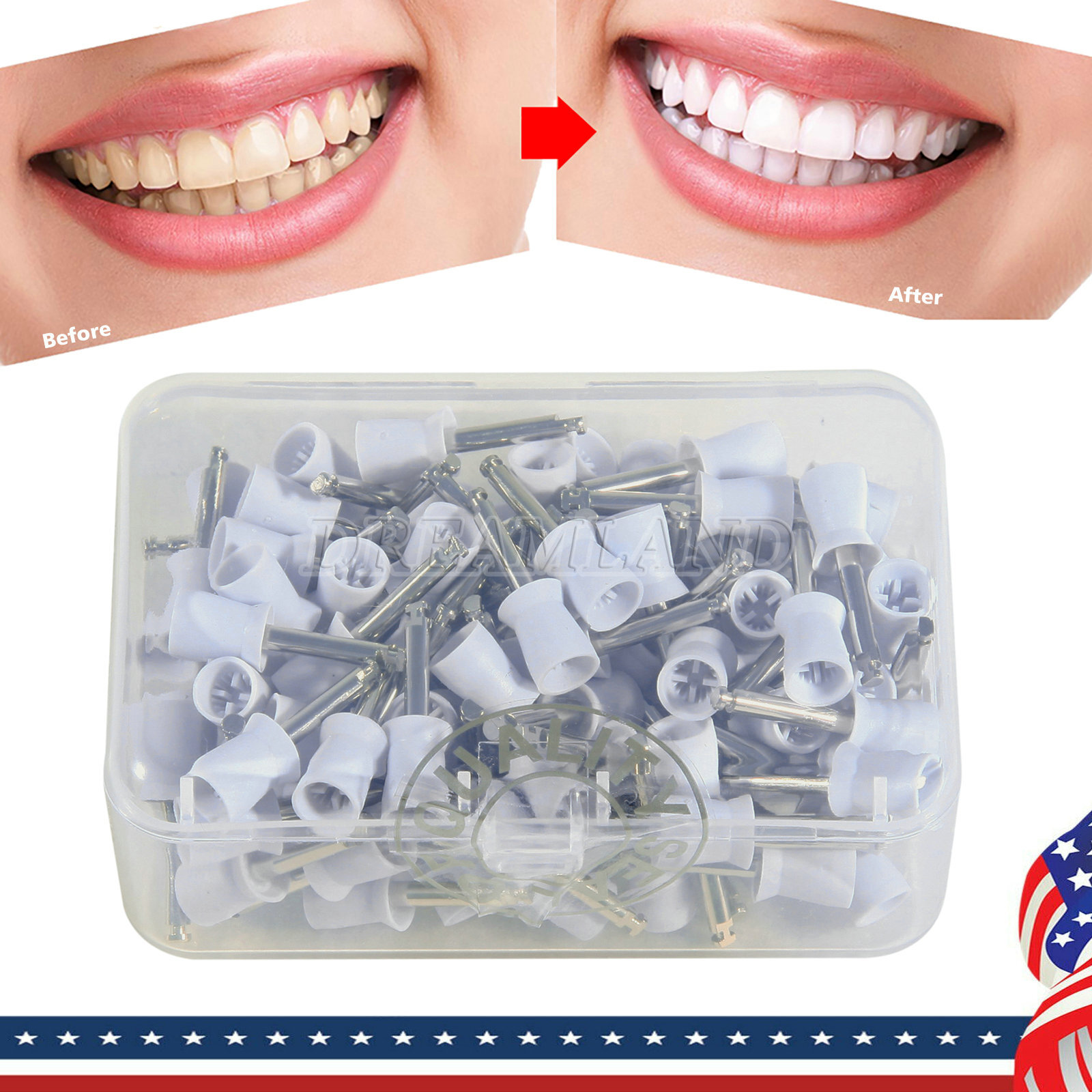 100 Pcs Dental Polishing Prophy Prophylaxis Cups Latch Type Rubber Polisher