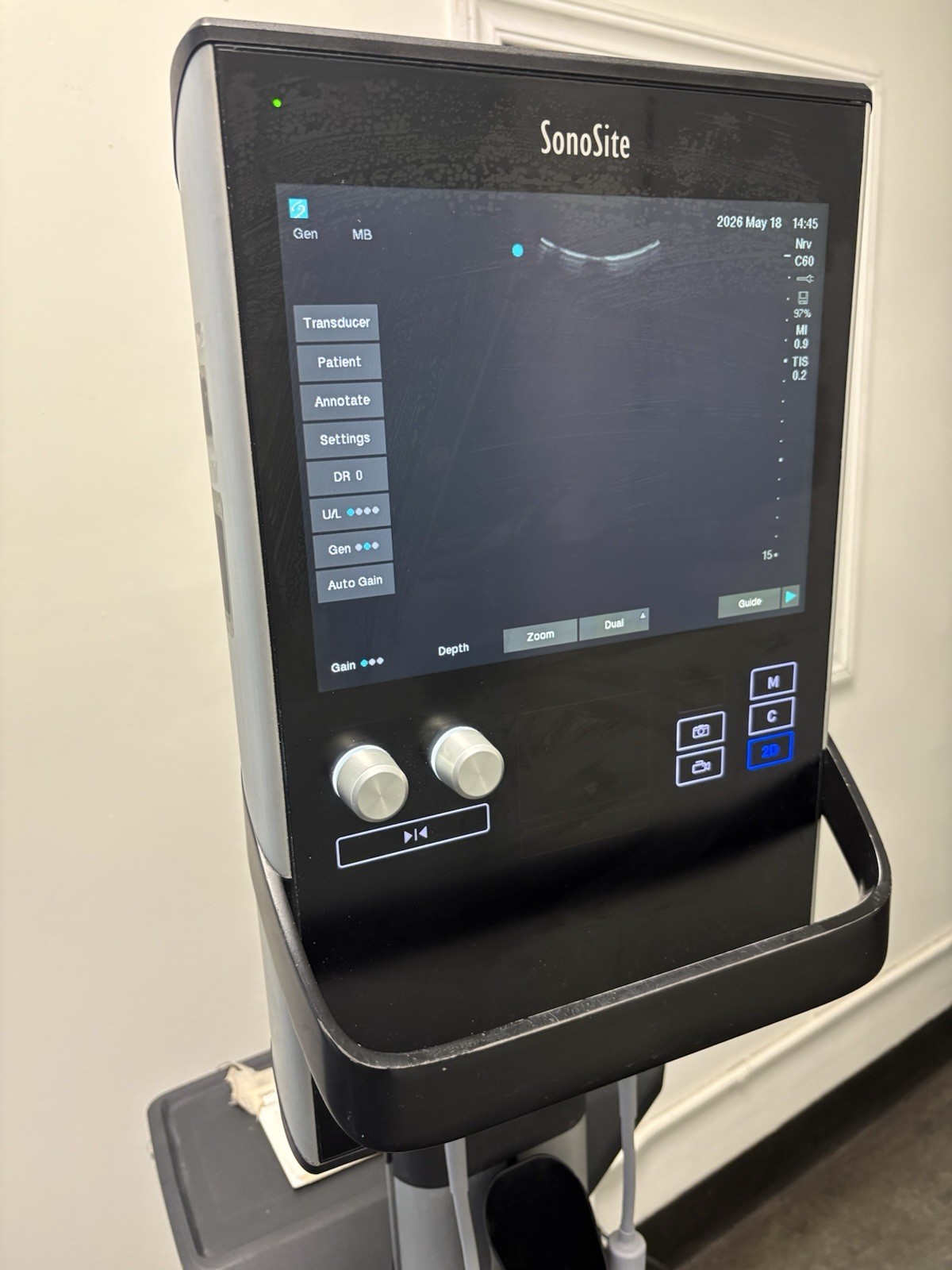 Sonosite SII Total Ultrasound System Ref P20883-12 With Three Probes (PLS READ)