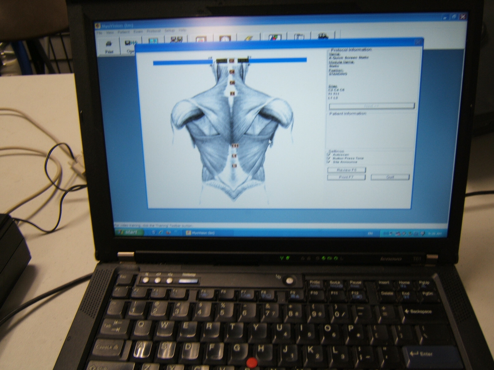 Myovision 8000 Static w/Dynamic sEMG wValidated Laptop Chiropractic Chiropractor