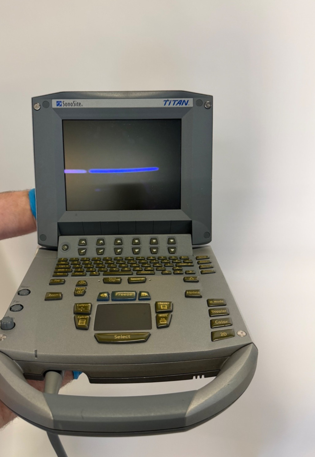 SonoSite Titan Portable Ultrasound System Only Monitor