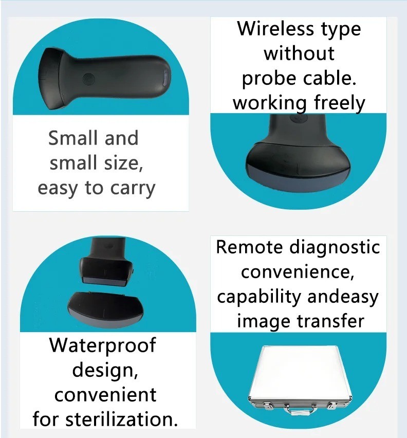 Wireless Ultrasound, Swappable Linear/Convex Probes, Palm Color Doppler Scanner