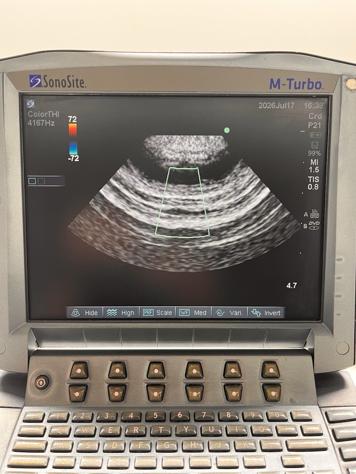 SonoSite M-Turbo Portable Ultrasound System P08189-70w/ P21x/5-1 MHz Transducer