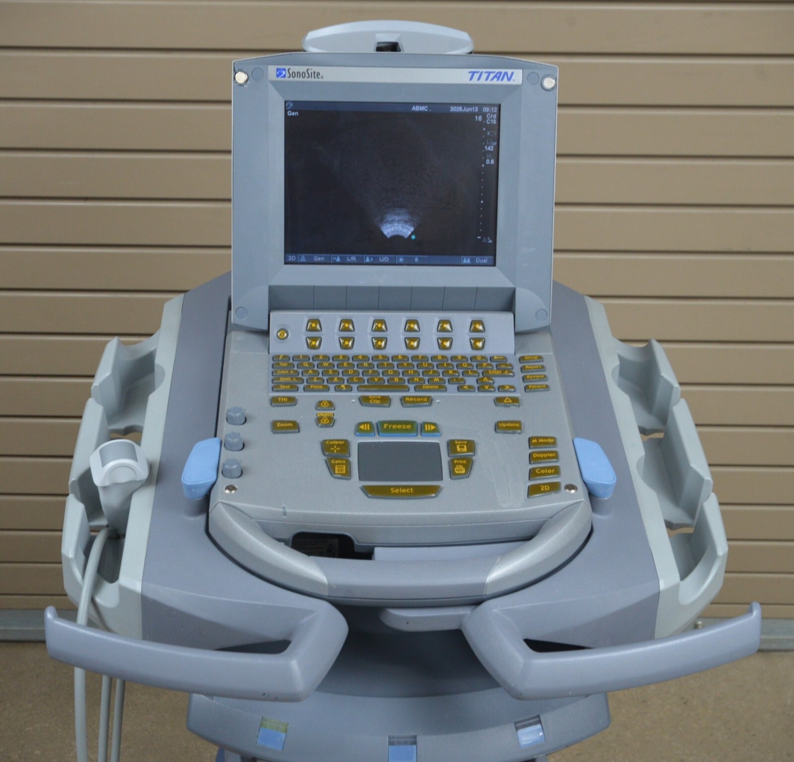SonoSite Titan High-Resolution Imaging System W/ C15/4-2 MHz & Cart