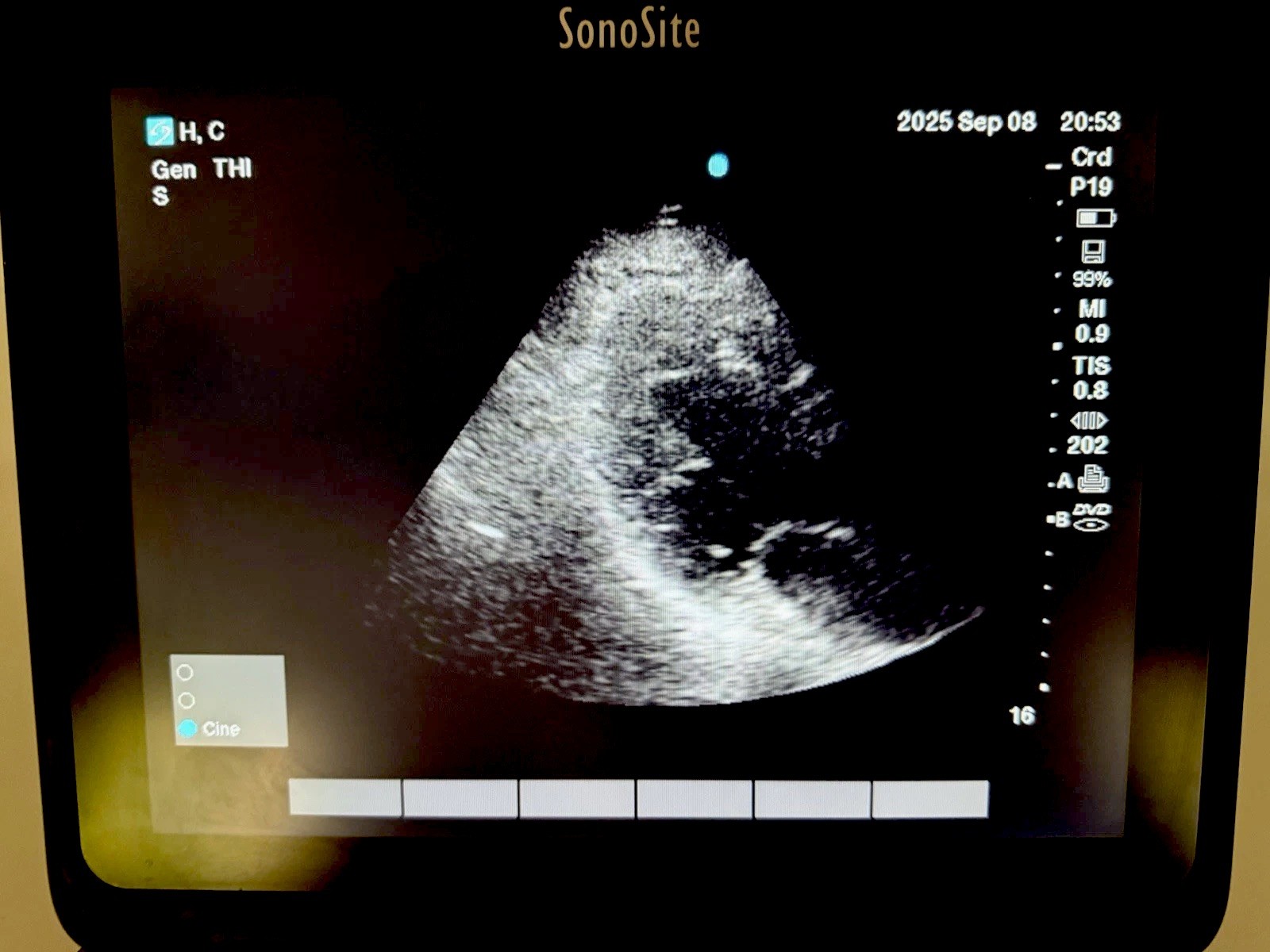 SONOSITE EDGE II 2018 Phased & Linear Transducers. 60 Day Money Back Guarantee