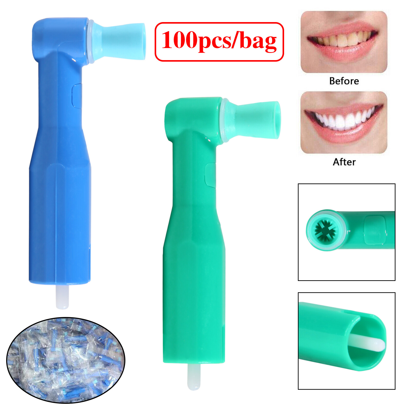 100 pcs Dental Disposable Prophy Angles Top Quality Money back guarantee