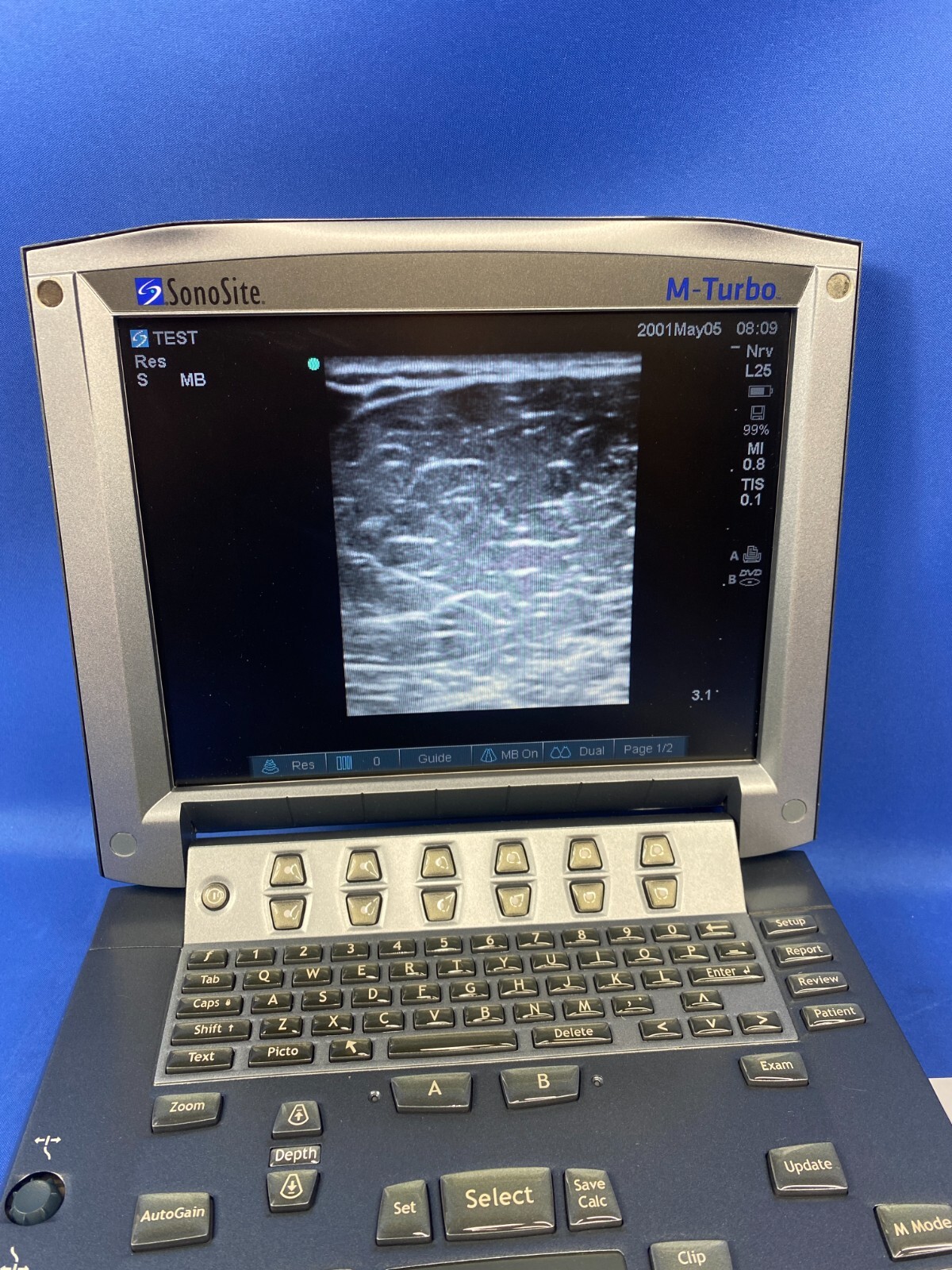 Fujifilm Sonosite L25x/13-6 MHz Ultrasound Transducer M-Turbo Edge Edge II S II